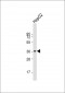 FOSB Antibody (Center P137)